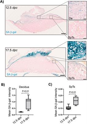 Linking DNA damage and senescence to gestation period and lifespan in placental mammals